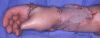 Nombre del archivo=mano_químico_8.jpg
Tamaño del archivo=24KiB
Dimensiones=486x187
Fecha añadida=Enero 19, 2007 mano_químico_8.jpg